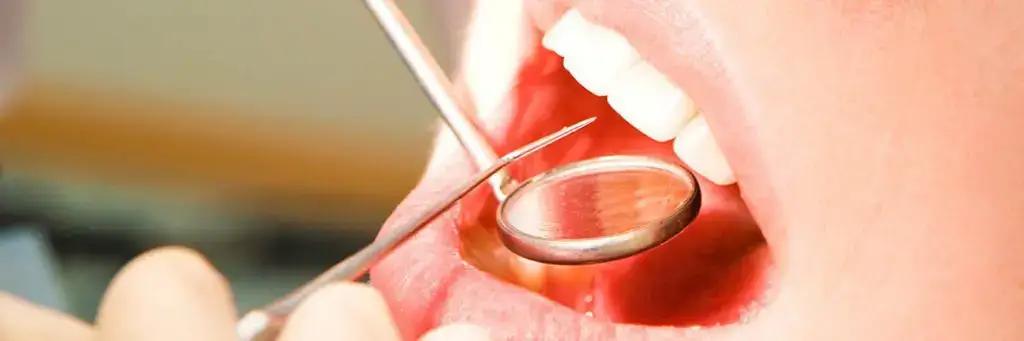 Understanding Root Canal Therapy