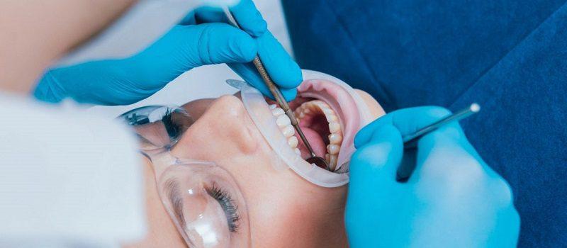 What is Oral Surgery?