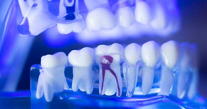 Endodontic Treatment For Those Requiring Root Canal Therapy