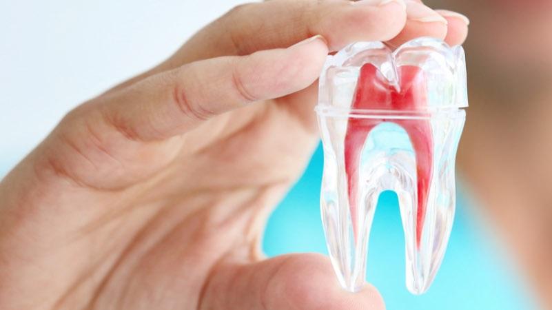 How Long Will My Root Canal Treatment Take?