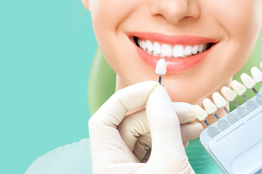 Learn the Differences Between Teeth Whitening and Professional Cleaning